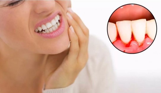 Причины кровоточивости десны