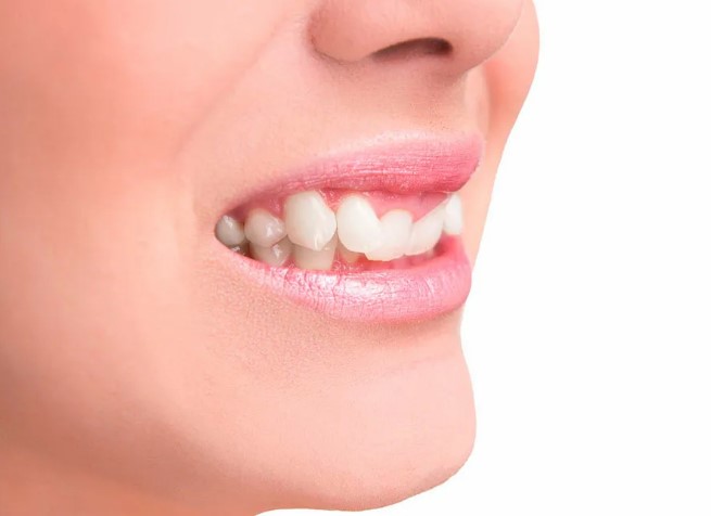 Неправильный прикус (аномальный): симптомы и лечение