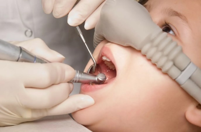 Седеция при лечении зубов у ребенка